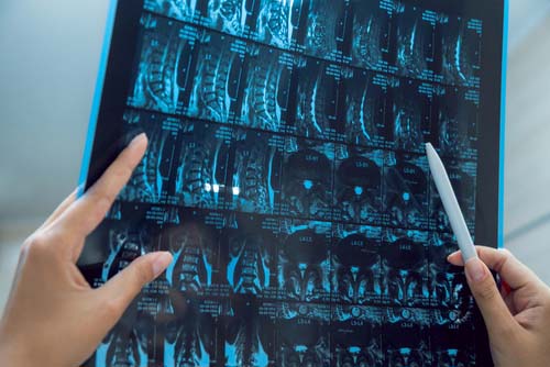 他覚的耳鳴りに関するよくある質問